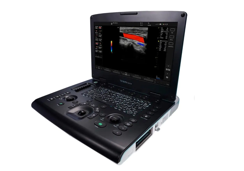 超声设备 Versana Active